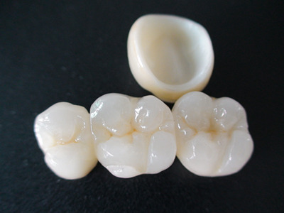 Zirconia and crowns