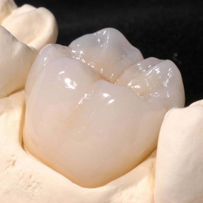 Zirconia and crowns