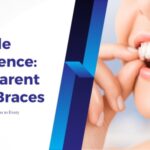 Transparent teeth braces