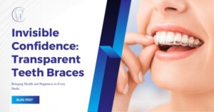 Transparent teeth braces